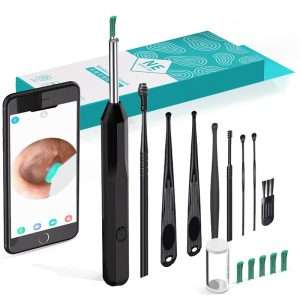 NE3 Wireless Visual Earpick – Smart Ear Cleaning Solution